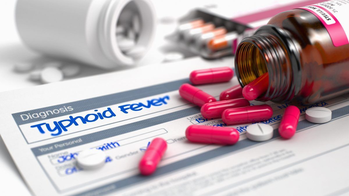 Demam Kepialu (Tifoid)
